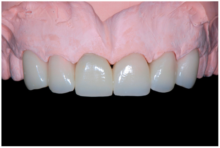 Figure 17