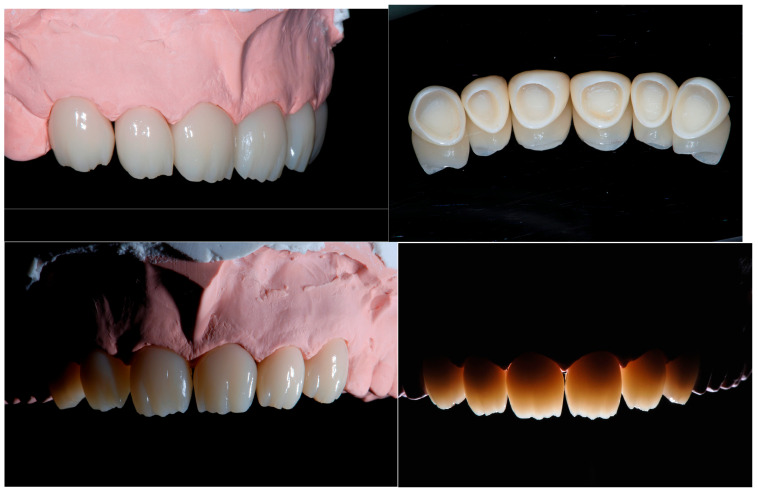 Figure 18