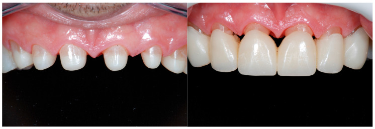 Figure 19