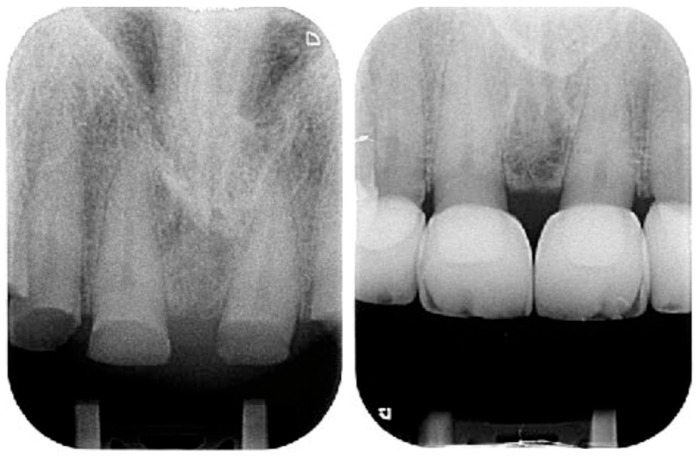 Figure 21