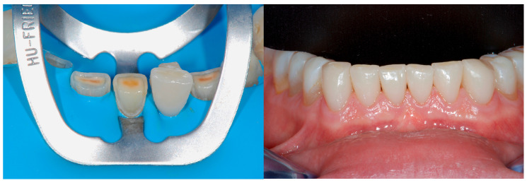 Figure 22