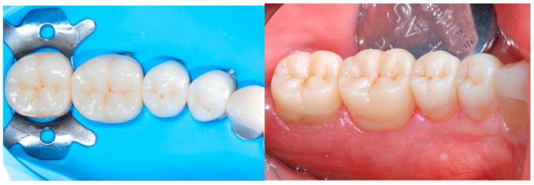 Figure 24