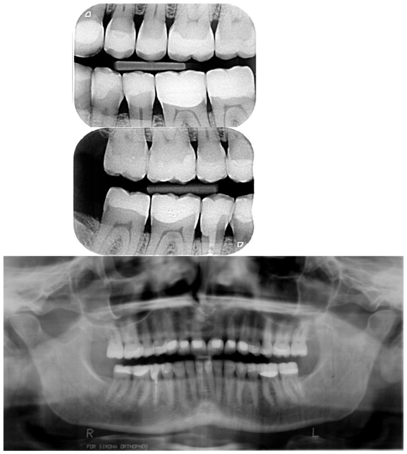 Figure 25