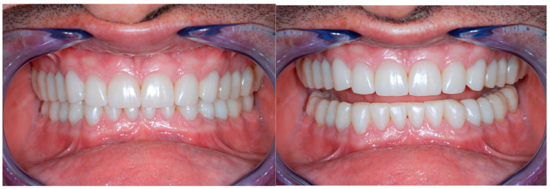 Figure 26