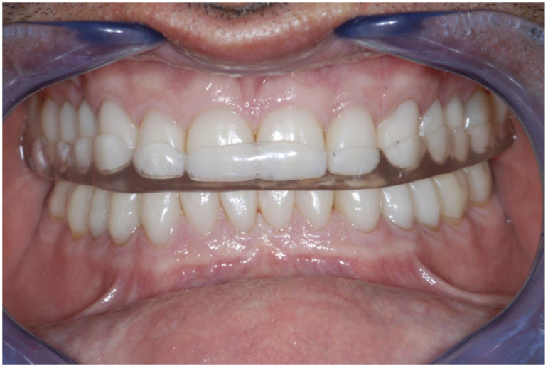 Figure 27