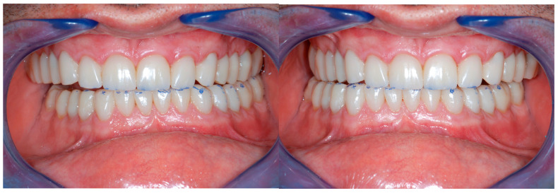 Figure 28