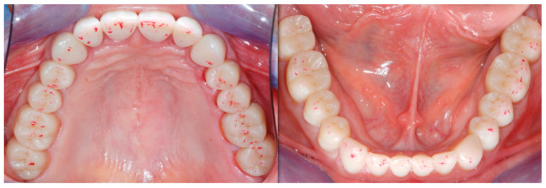 Figure 29