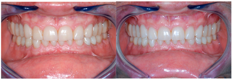 Figure 30
