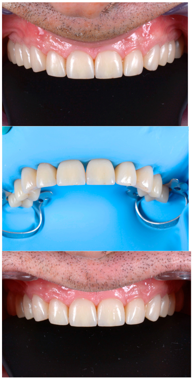 Figure 31