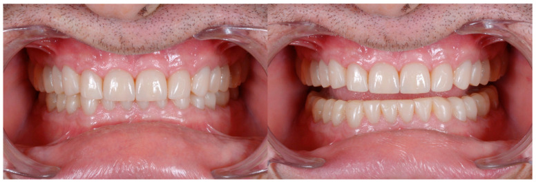 Figure 33
