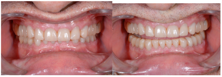 Figure 34