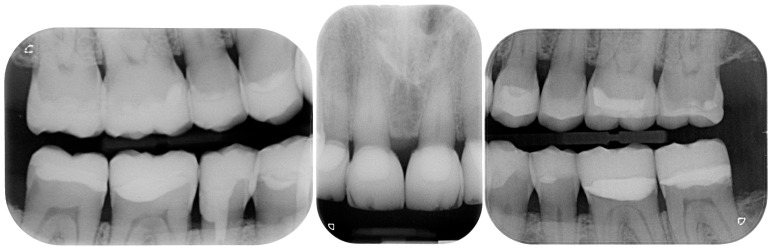 Figure 36