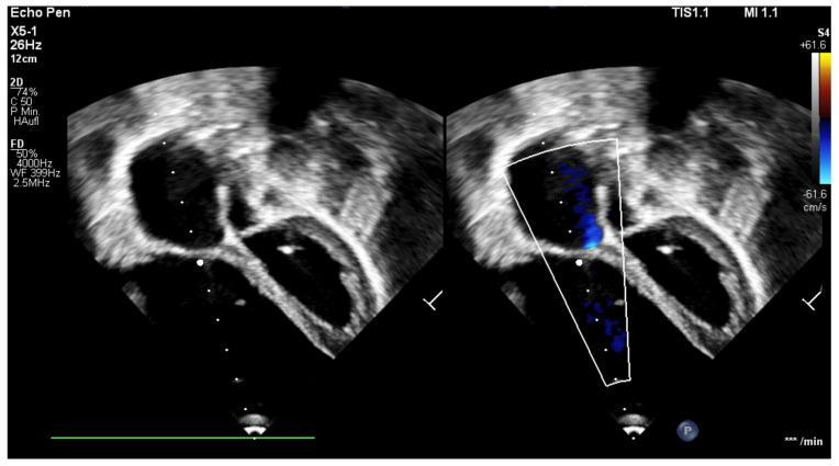 Figure 6