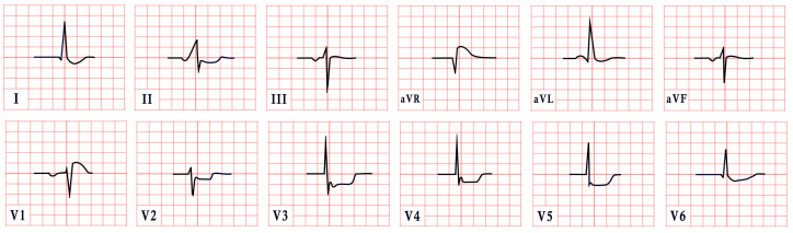 Figure 12
