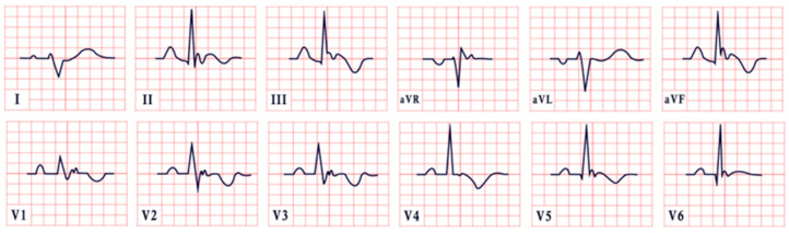 Figure 13