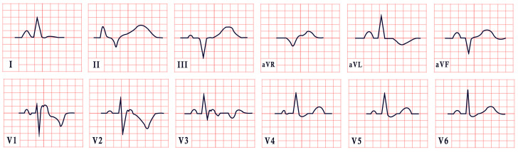 Figure 14