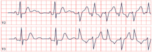Figure 18