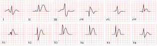 Figure 20