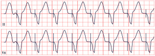 Figure 21
