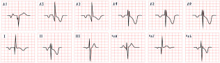Figure 22