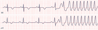 Figure 23