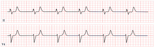 Figure 25