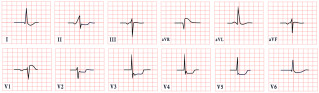 Figure 26
