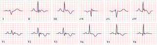 Figure 27
