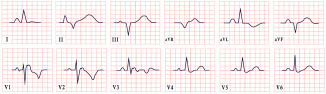 Figure 28