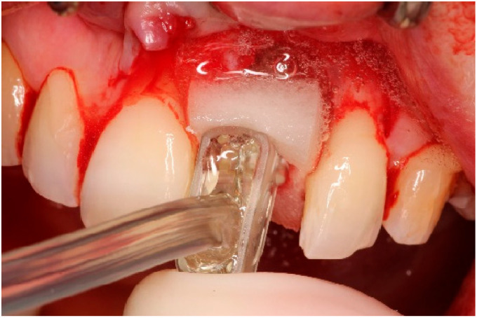 Figure 6