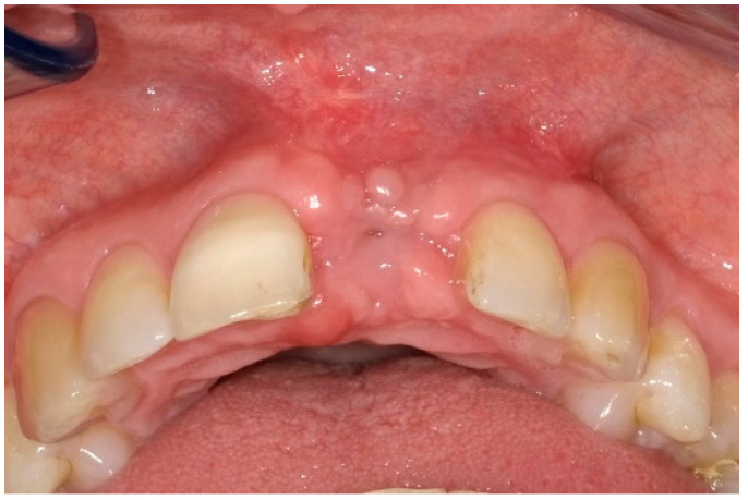 Figure 10
