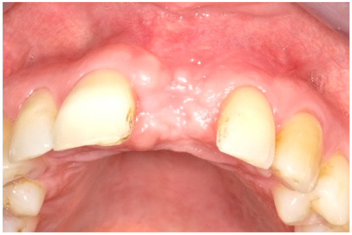 Figure 11
