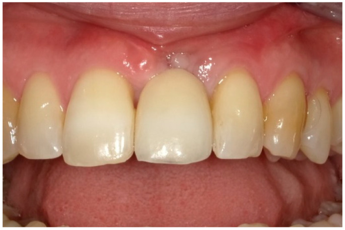 Figure 12