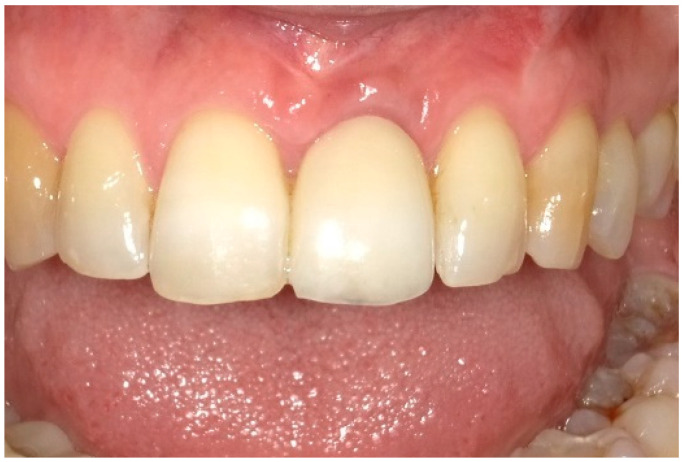 Figure 13
