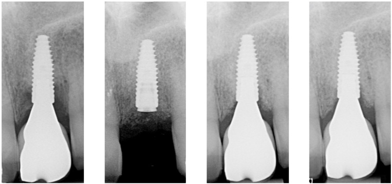 Figure 14
