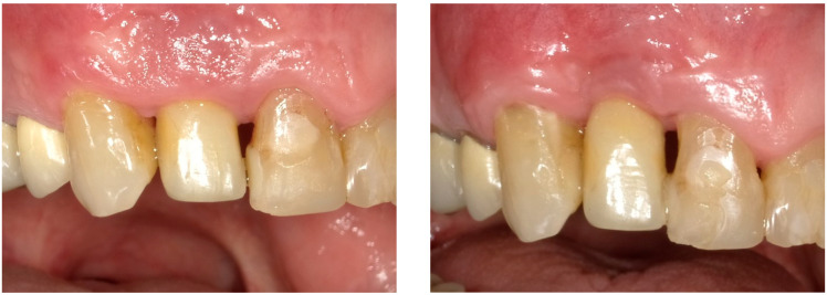 Figure 17