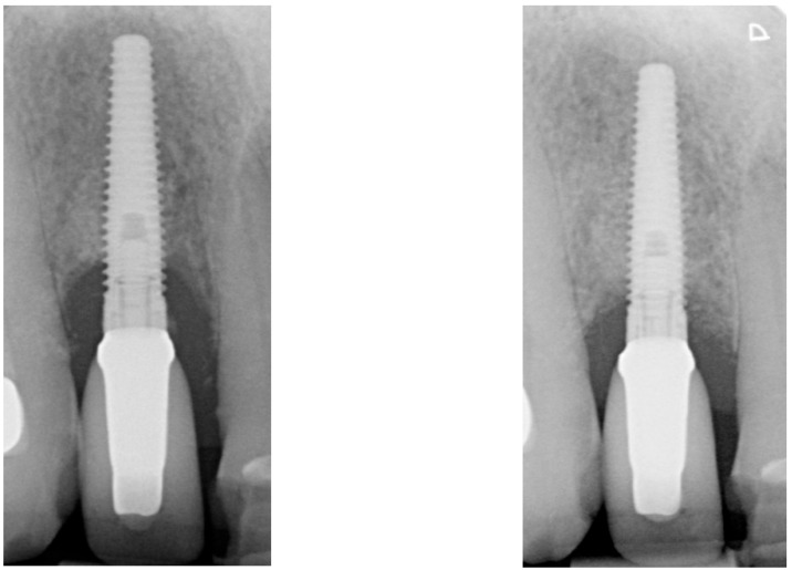 Figure 18