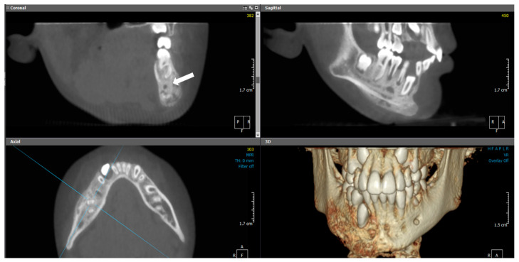 Figure 10