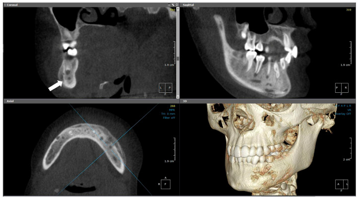 Figure 12