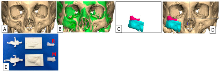 Figure 2