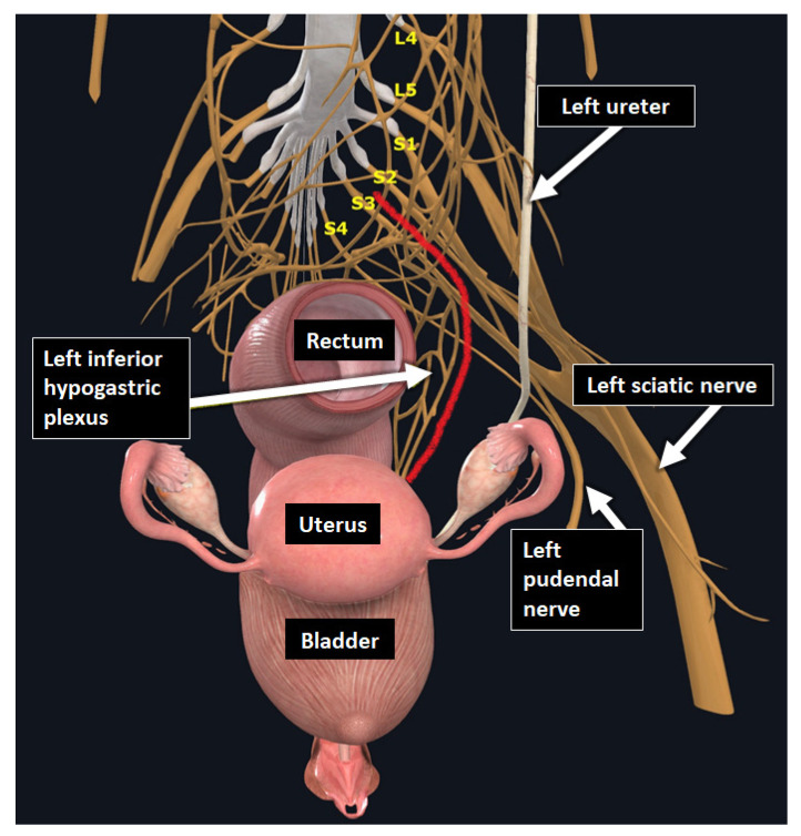 Figure 14