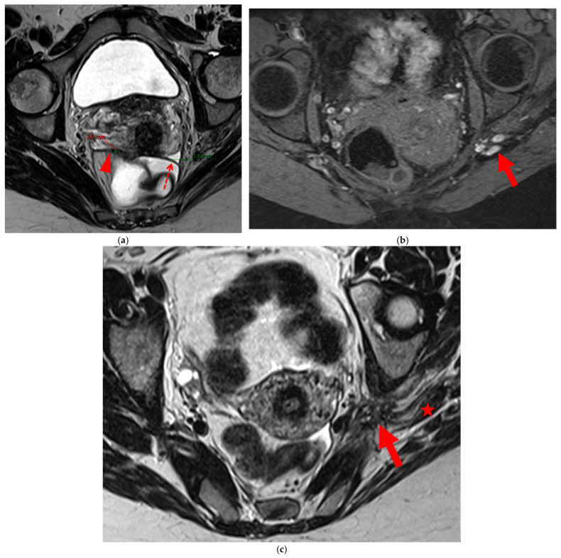Figure 17