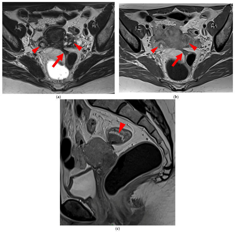 Figure 18