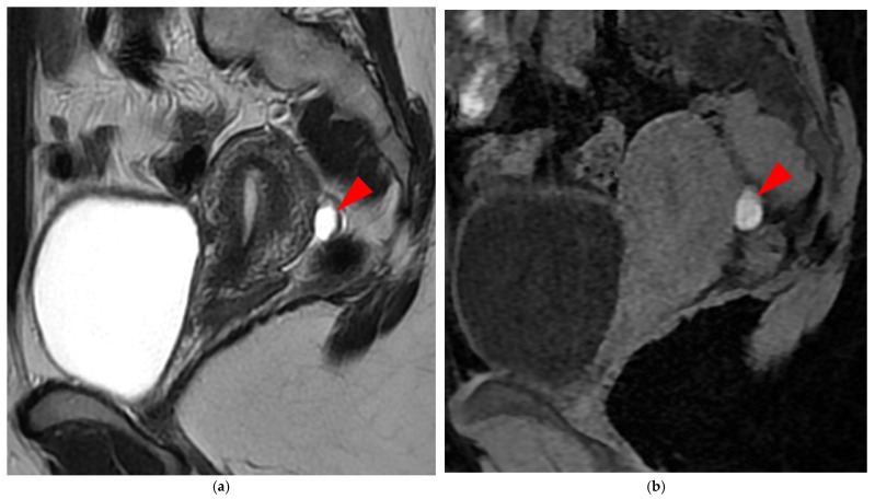 Figure 19