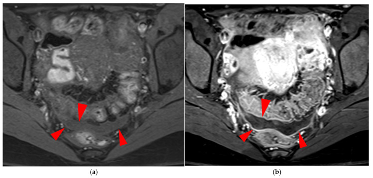 Figure 20