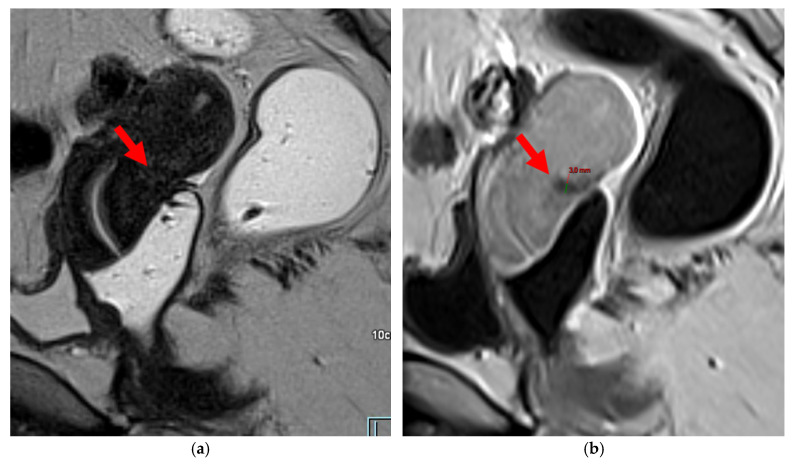 Figure 21