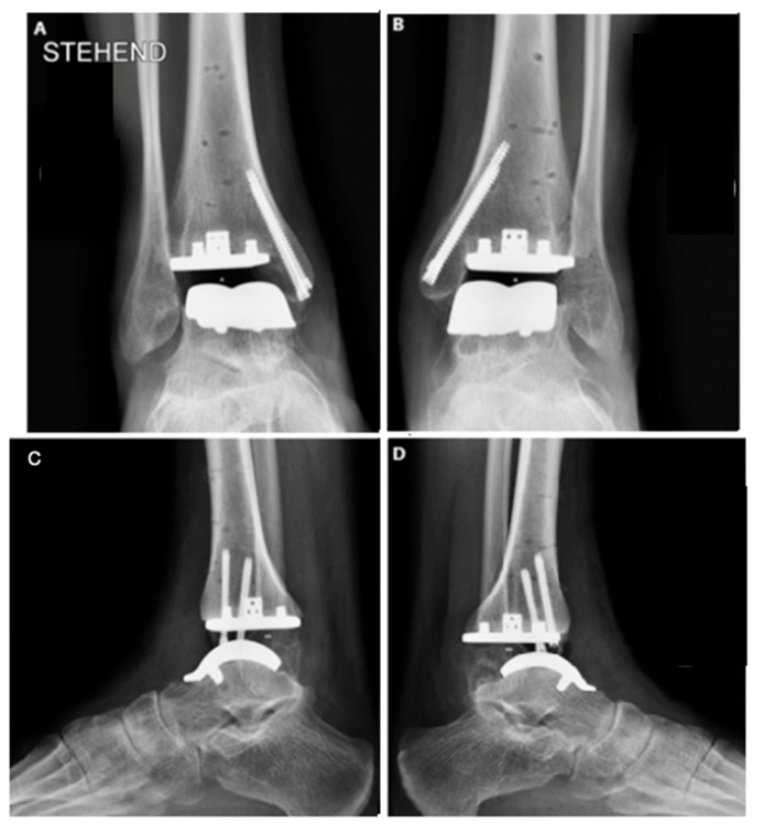 Figure 4