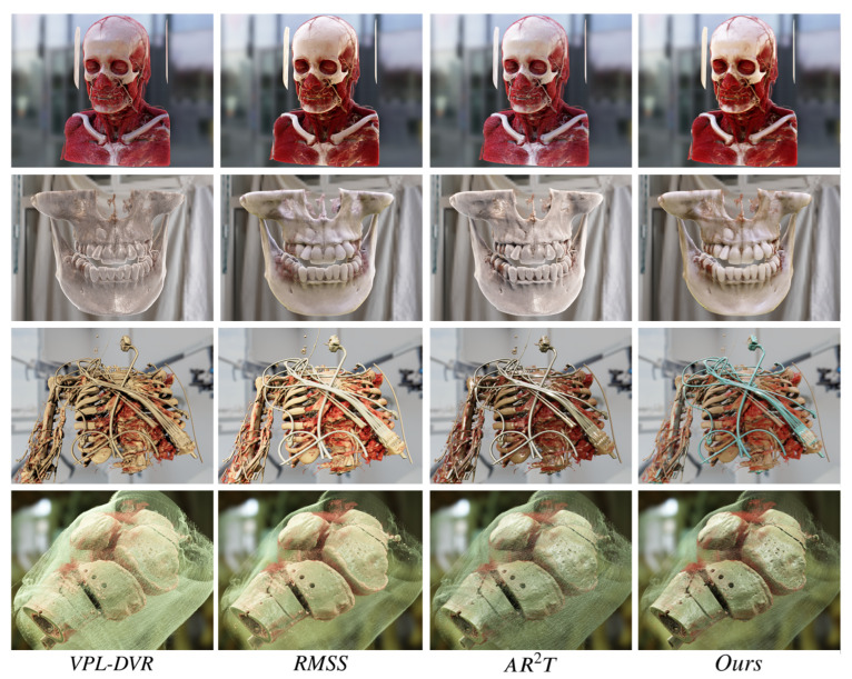 Figure 11