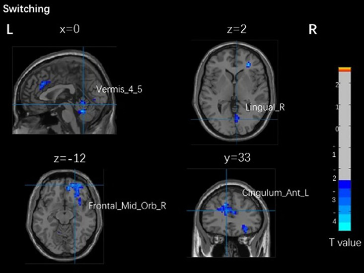 Fig 4