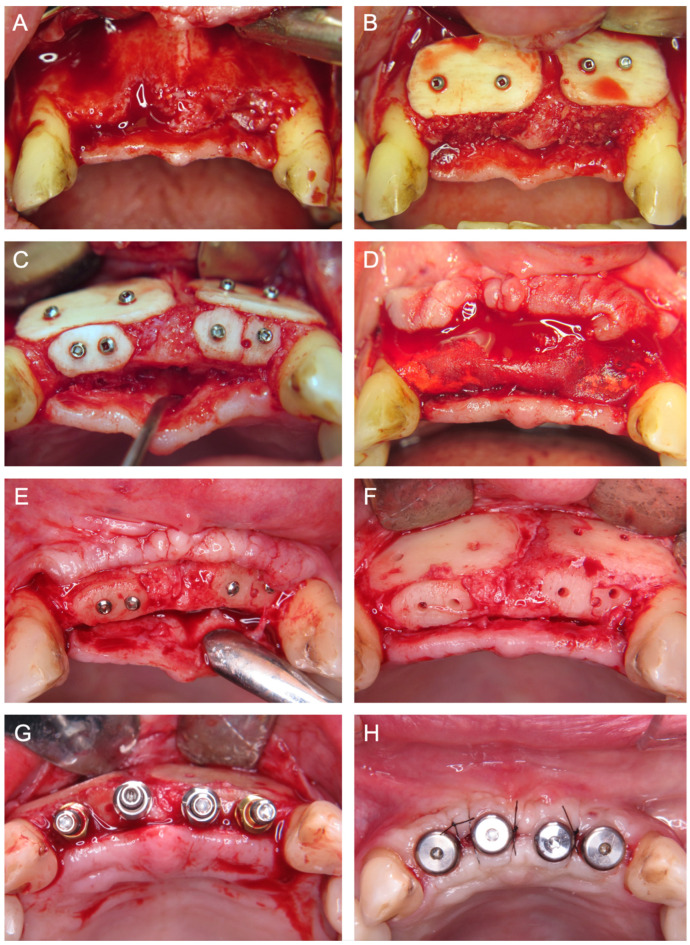 Figure 7